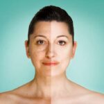 chirurgie esthétique